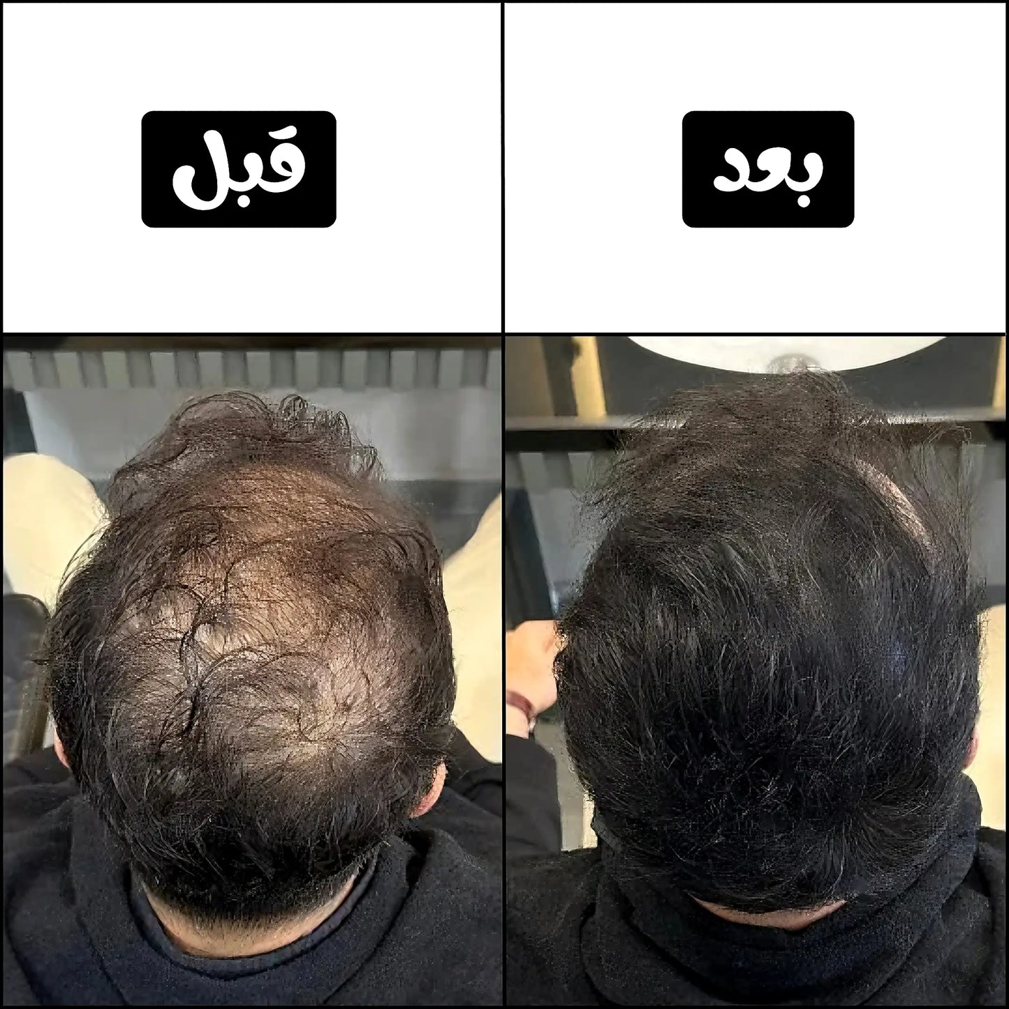 BATCI PRO™ - خافي فراغات الشعر لا يزول بالشامبو