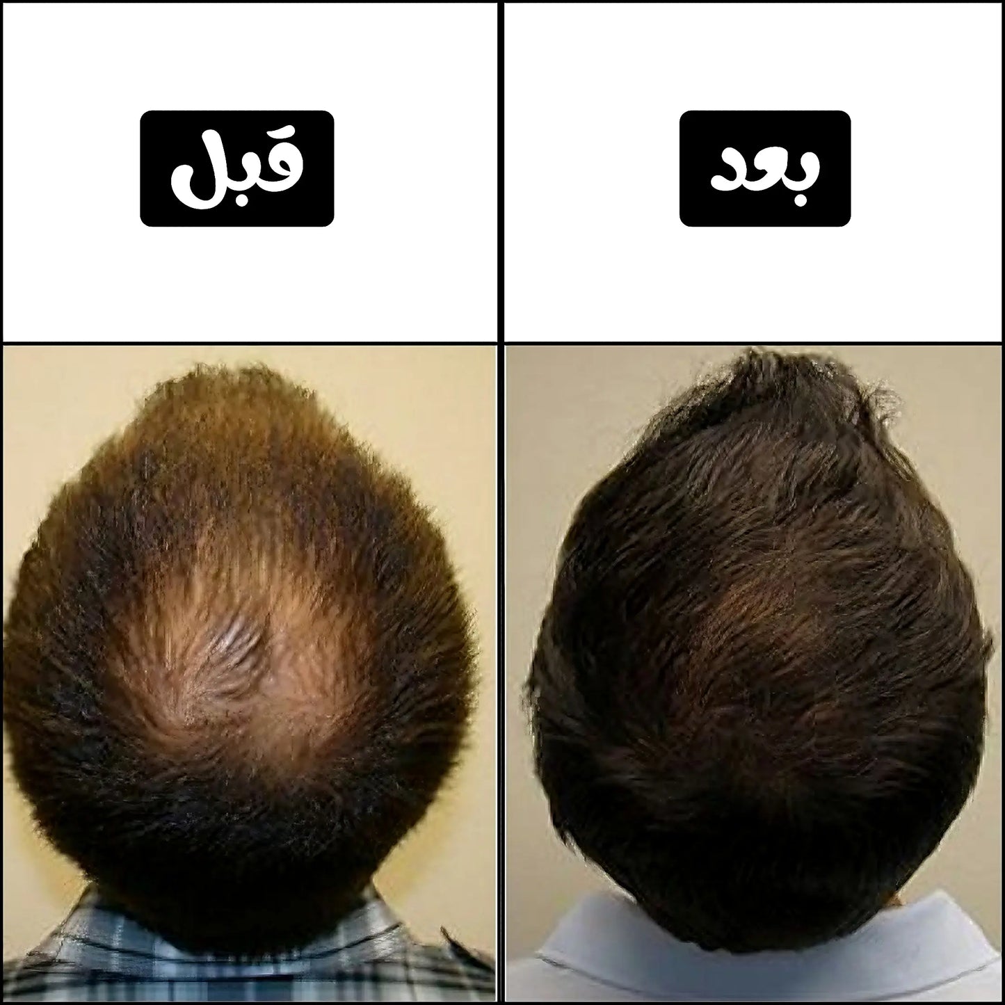 BATCI PRO™ - خافي فراغات الشعر لا يزول بالشامبو